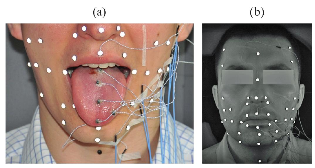 Fig. 3. Arrangement of articulograph sensors (a) and facial markers (b)  movements of external articulators (e.g. lips, jaw and cheeks). One video camera was placed in front of the speaker and two others captured the image of both sides of the speaker’s head. The number of the cameras used in this system allowed to obtain 3D positions of the facial OptiTrack markers through correlating the recorded 2D images. The arrangement of EMA sensors and reflective facial markers as used in the research is presented in Fig. 3.  
