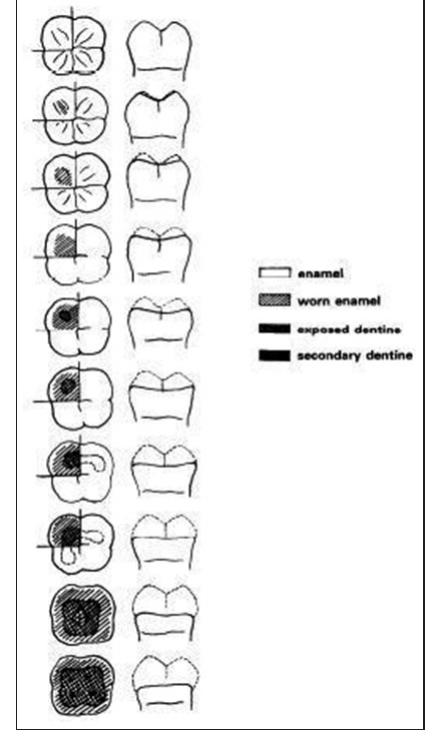 Figure 3: “Stages of crown attrition on molars from top to bottom: Stages 0-9” — the average stage of attrition is the average stage of the attrition on all cusps of a molar when evaluating the attrition degree from stages 0-7 for each cusp. The eighth and ninth stages of attrition are estimated from the attrition condition of the entire occlusal surface. The attrition degree is divided into ten stages 