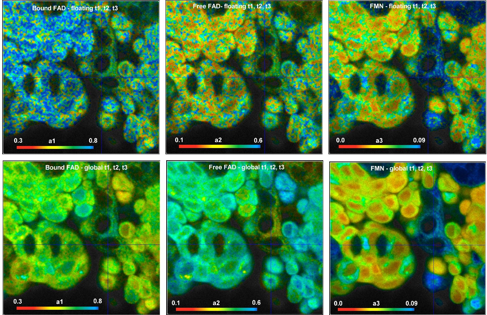 Fig. 3 Left to right: amount of bound FAD, al, the amount of unbound FAD, a2, and the amount of FMN, a3. Upper row: Standard MLE fit. Lower row: Global fit with component lifetimes t1, t2, t3 defined as global parameters.  An example is shown in Fig. 3. It shows FAD data from freshly excised human bladder tissue. The ipper row shows conventional triple-exponential decay analysis with all three component lifetime: ‘reely floating. Left to right, it shows the amount of bound FAD, al, the amount of unbound FAD. 12, and the amount of FMN, a3. The photon number in the individual pixels is about 100. To obtair ‘easonable al, a2, and a3 data a binning radius of 3 was used in SPCImage NG. This results ir about 5000 photons per binned pixel. Please see [2] for details of the binning procedure. It can be seen that the MLE fit is generally able to derive reasonable triple-exponential decay parameter: form the data. However, the accuracy of the decay amplitudes is not really satisfactory. 