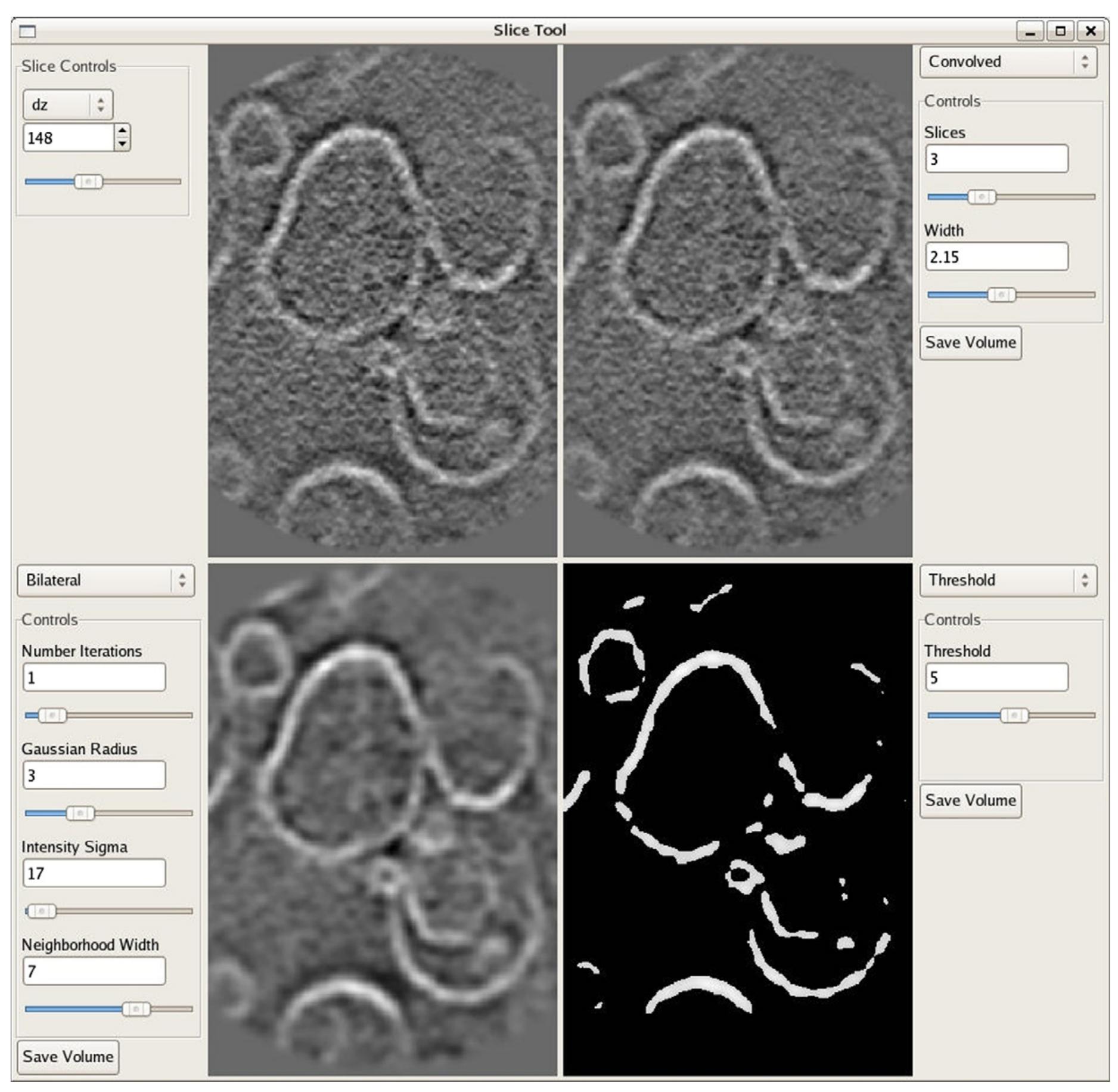 Fig. 3. The first full GUI application written in EMAN2. This is an interactive filtration tool for optimizing filters in tomographic reconstructions 