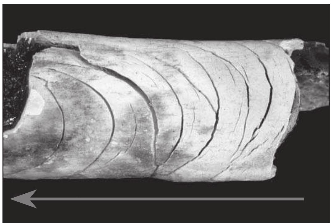 FIGURE 2.19 Once kinetic energy in muscles builds up and shrinking fibers begin to break free of connective restraints, the bone is systematically exposed. This jerky movement occurs in this case up the femur shaft as indicated by the residual curved transverse fractures. Extended exposure creates a heat shrinkage fracture on a femur at the point where tissue borders the exposed bone. These fractures are generally concave on the tissue side, as indicated by the  arrow.  A common place for curved transverse fractures is on the shaft of the femur. In a typical fire, the first place to burn on a femur is the anterior knee area. As the fire consumes and separates the knee from the rest of the bone, tissue thickness increases dramatically in the fire destruction path along the diaphysis due to the powerful lower limb muscles, and thus the limb becomes progres- sively more resistant to heat destruction. In this way, due to tissue protection, 