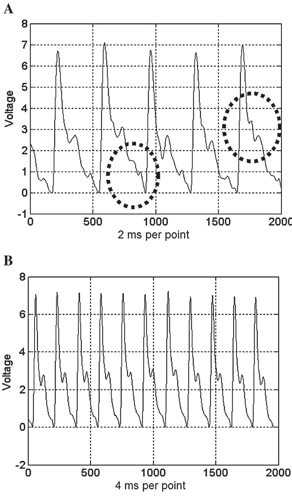 FIG. 4. Comparison of pulse waveforms acquired by different pulse sensors 