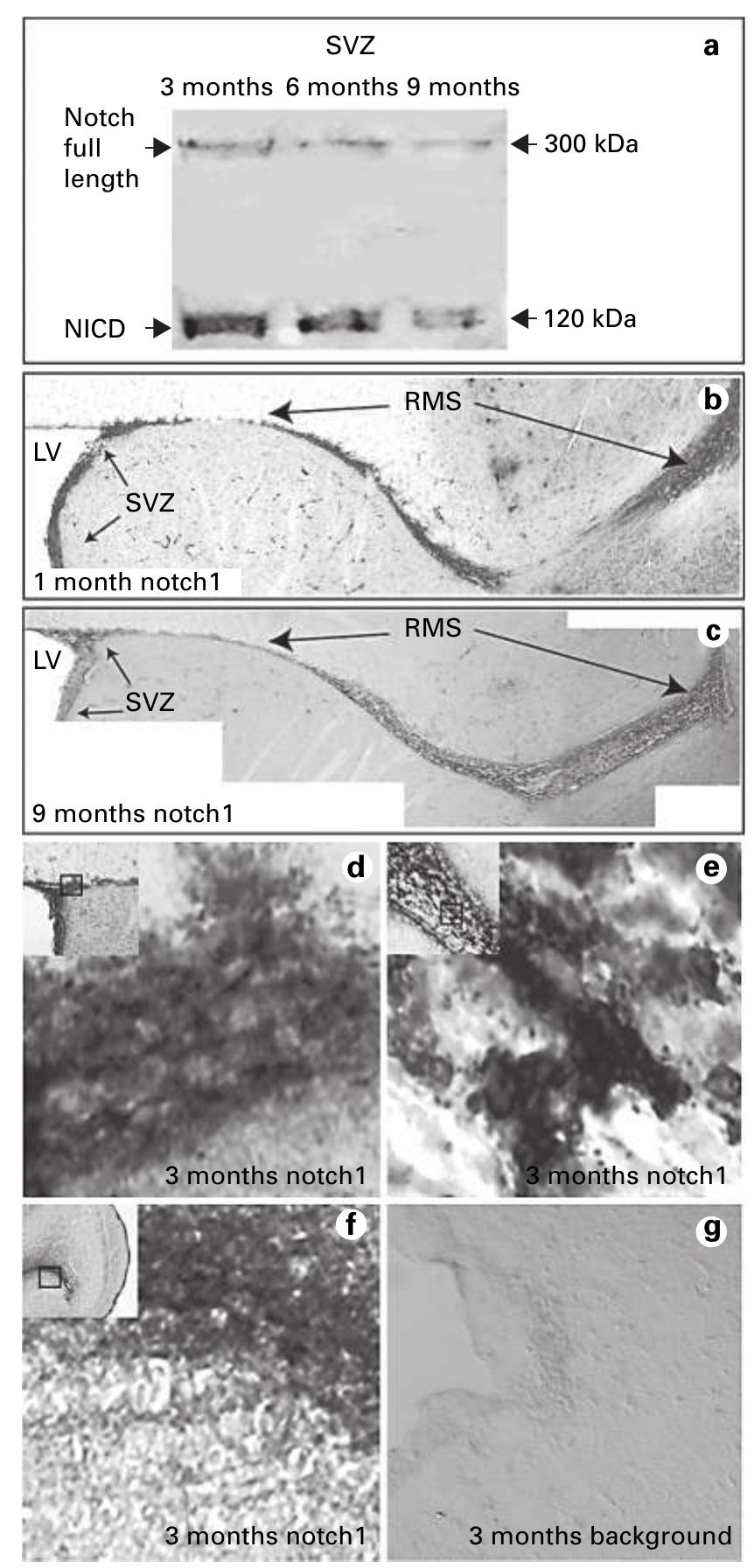 Fig. 1. Postnatal expression of Notch! receptor in the SVZ and RMS. a Abundance of full length and NICD was evaluated by immunoblot analysis of protein extracts prepared from SVZ acutely isolated at 3, 6 and 9 months. b, ¢ Immunoreactivity of Notch receptor along the SVZ-RMS-OB pathway at | (b) and 9 months (c). Magnification x 10. d-f High-magnification (x 100) pictures showing Notch-pos- itive cells within the SVZ (d), RMS (e) and OB (f). Background im- munostaining is shown in g. LV = Lateral ventricle. 