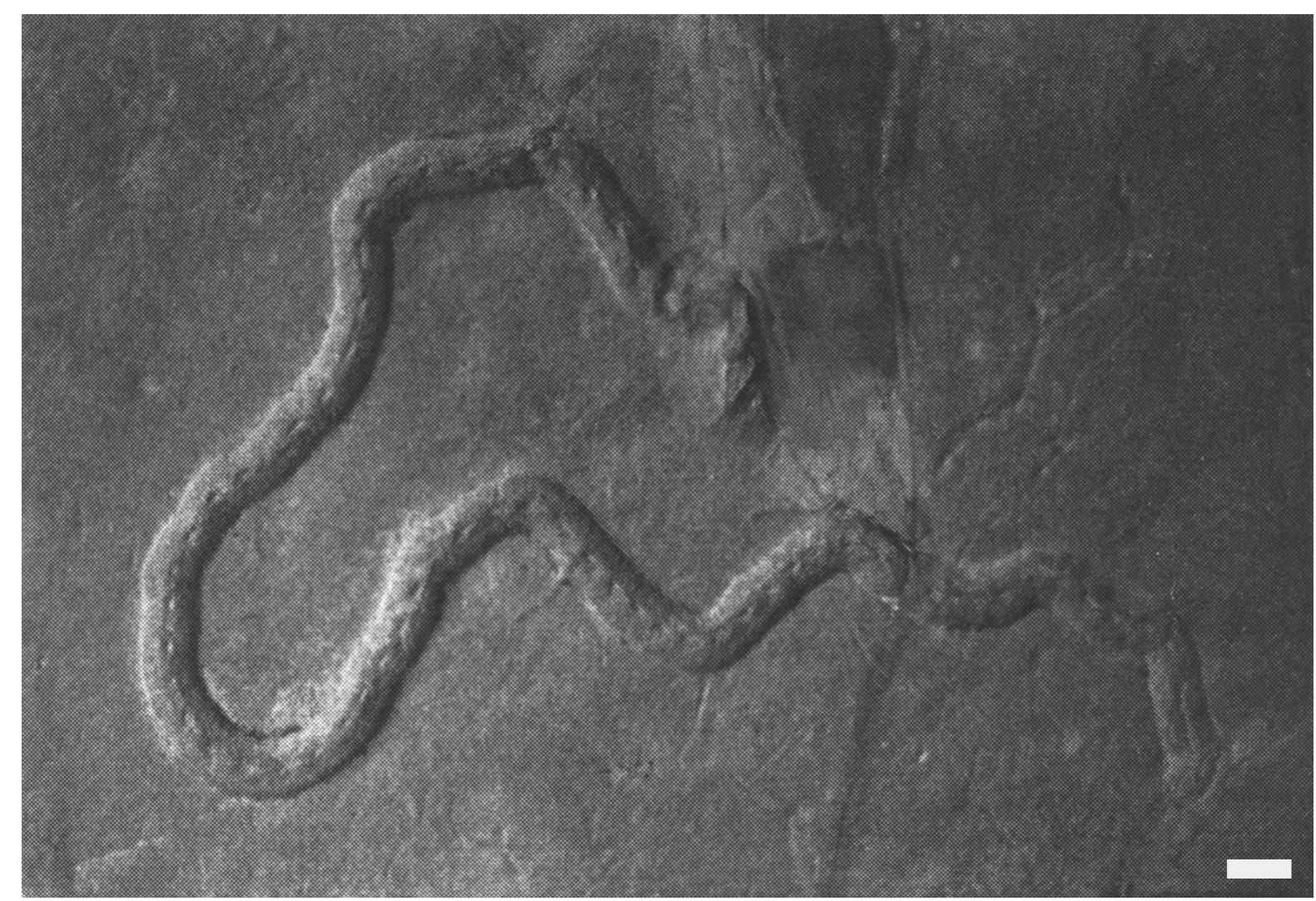 FIG. 7. Psammichnites grumula. Specimen showing unique elongate dorsal holes. Coal Formation, Haltwhistle, England. OUMNH E.5033. Scale bar = | cm. 