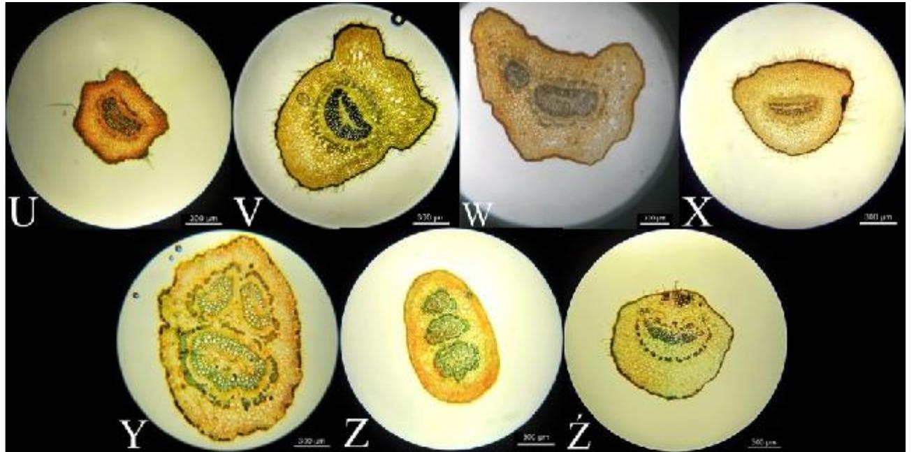 Fig. 1 (U-Z). Cross section of petiole under optical microscope with a magnification of 10x: U. Salix silecisa (Vrchy Mts.), V. S. viminalis, W. S. waldsteniana, X. S. xanthicola, Y. Populus alba, Z. P. nigra, Z. Bivinia jalbertii (Bars = 300 um). 