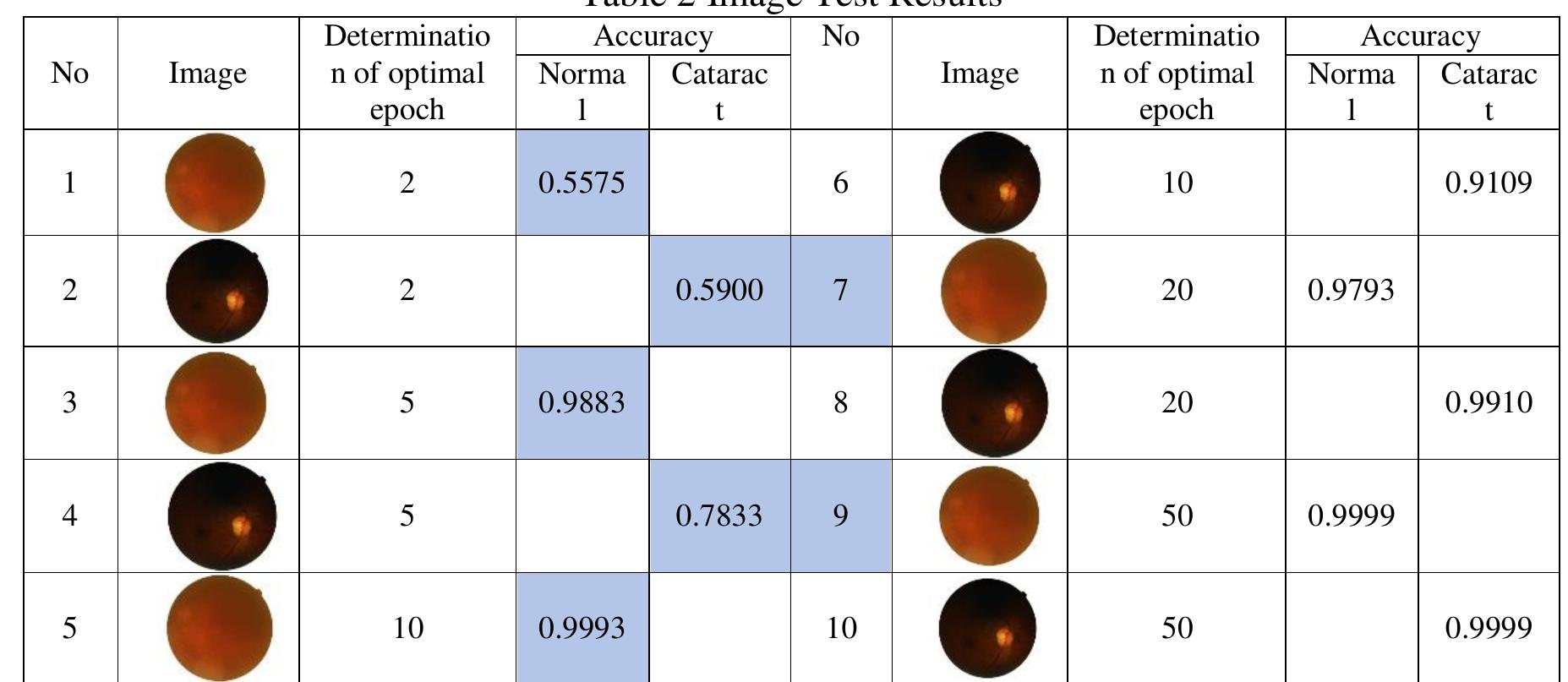 Based on the table above, it can be seen that the more epoch values used, the better the accuracy results from image testing. Of course not only is this a determinant of the level of accuracy of the image test results but also many things such as the number of datasets, image dimension sizes, and others but in this study, the focus is on the learning rate value and the number of epochs. The prediction results from the model obtained on the tested dataset showed very good results, namely an average accuracy of 88% which can be seen in Table 2 as follows: 