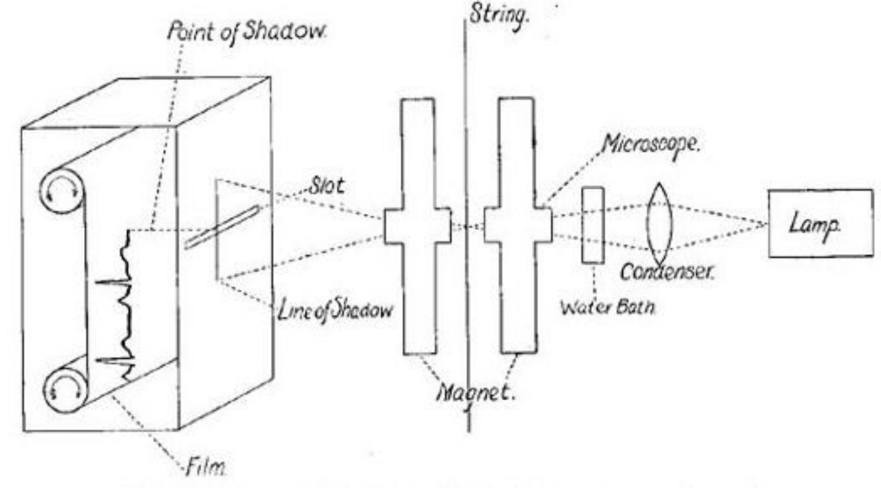Fig. 34: Einthoven’s recording schema 