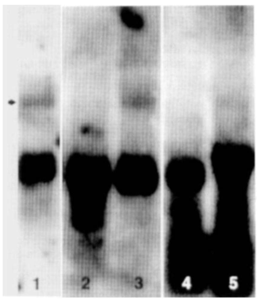 Fig. 2. Northern analysis of rat testis cells probed with testis OPN cDNA. Poly (A)' RNA was isolated as described in Materials and Methods; 15 pg RNA was loaded per lane and separated on a 1.2% denaturing agarose gel, transferred to a nylon membrane, and hybrid- ized with ("P]dCTP nick translated testis OPN cDNA. Ribosomal 58 subunit cDNA was used as control. Lane 1: testis, lane 2: interstitial cells, lane 3: adult Sertoli cells, lane 4: pachytene spermatocytes, lane 5: round spermatids. RNA size standards were run in an adjacent lane,  which was excised and stained with ethidium bromide. Arrow indi- cates 1.4 kb. 