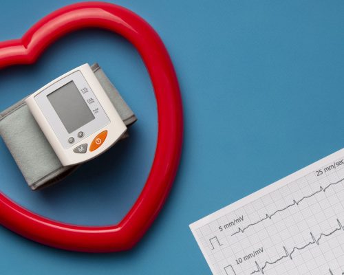 Premature Atrial Complex